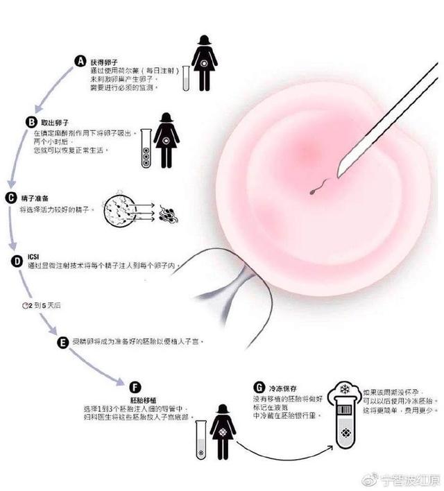 口腔溃疡