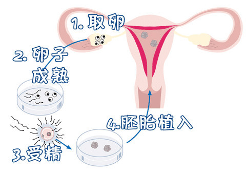 新生宝宝