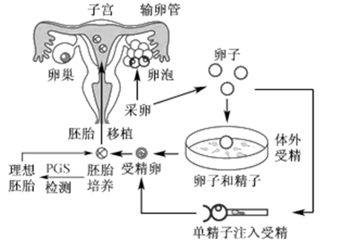 终止妊娠