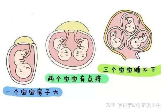 瑜伽