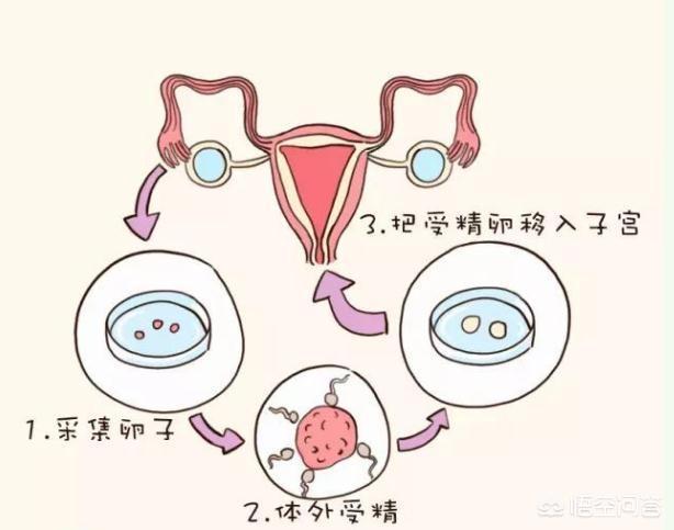 避孕
