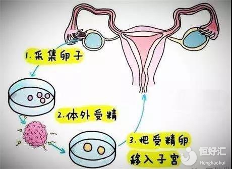 红莲稻米