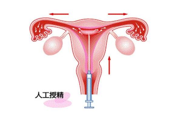 肥胖纹