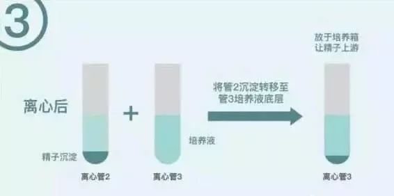肠胀气