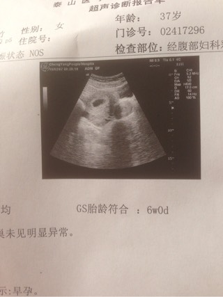 美格恩早早孕试纸