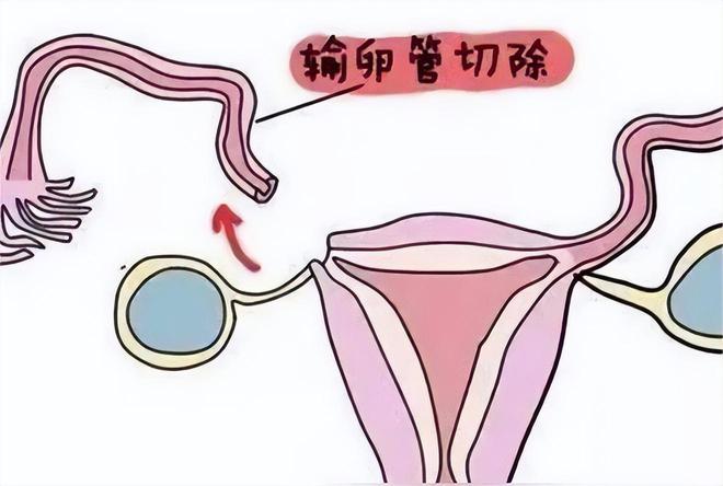 老婆生日蛋糕文案