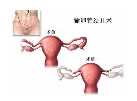 育儿书籍